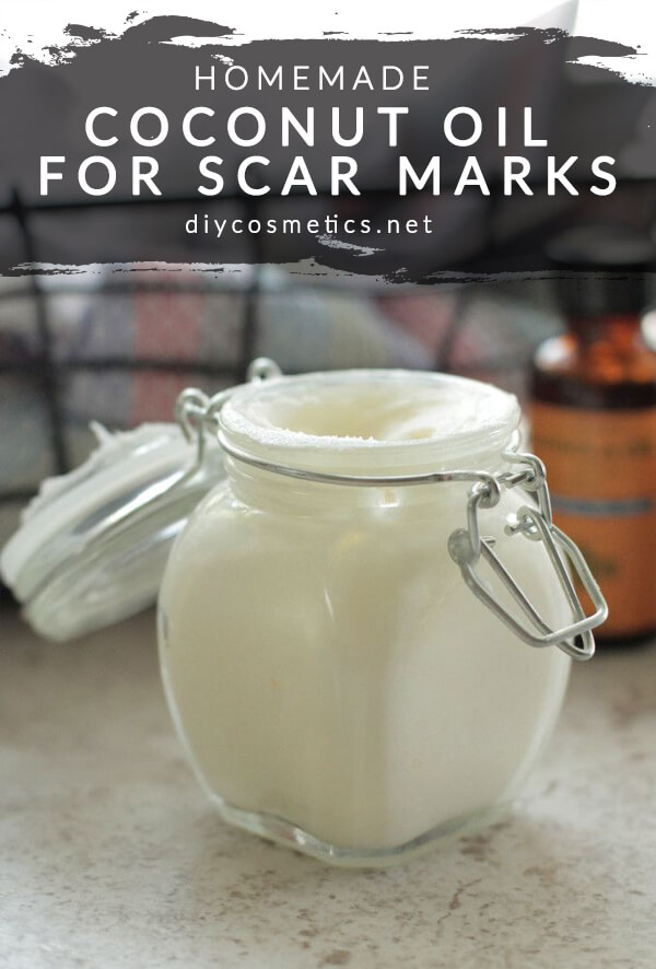 Homemade Lotion with Coconut Oil for Scar Marks