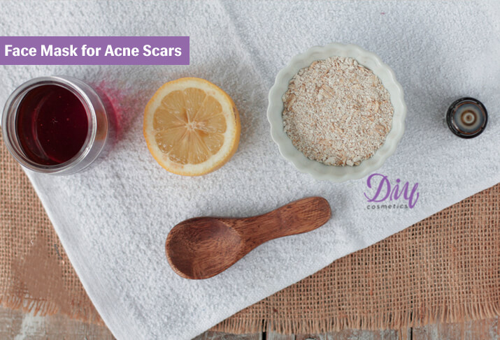 5 Super Easy Face Mask for Acne Scars