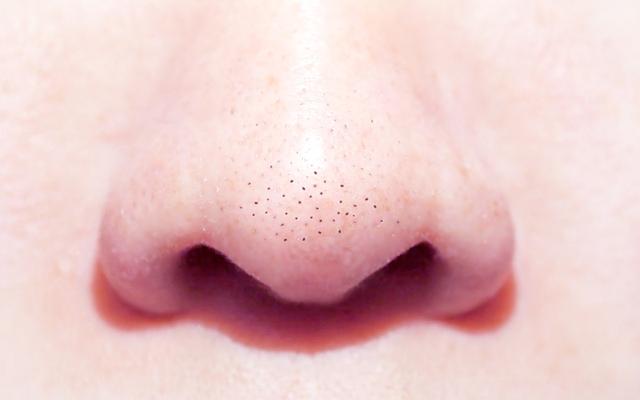 Things to Know About Small Blackheads