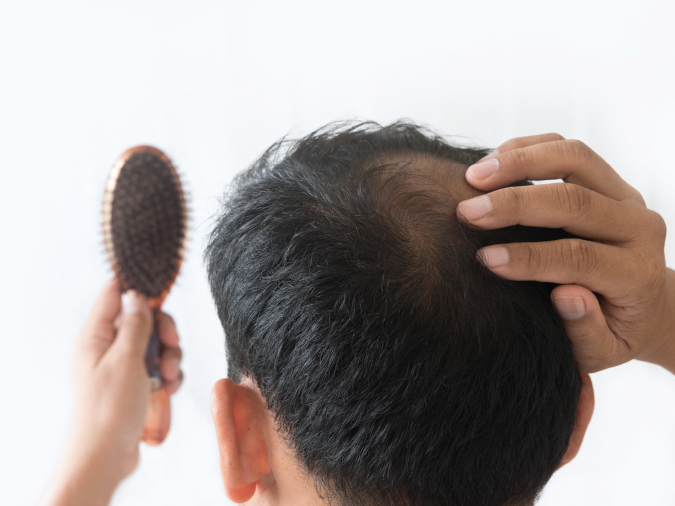 Folic Acid and Hair Loss - How Do They Relate?